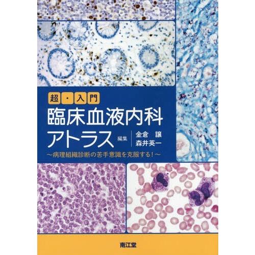 超・入門臨床血液内科アトラス 病理組織診断の苦手意識を克服する