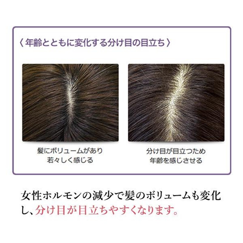 デルメッド公式】 ヘアエッセンス 120mL 医薬部外品 育毛剤 女性用 薬用 薄毛 抜け毛 増毛 発毛 促進 頭皮 スカルプケア ヘアケア  エイジングケア 髪 頭皮 | LINEブランドカタログ