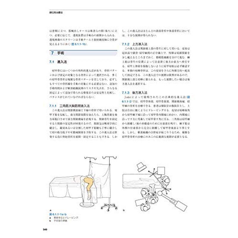 AO法骨折治療英語版Web付録付 第3版