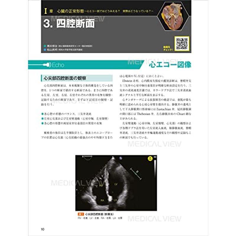 心エコー図検査に役立つ ヒト心臓形態のすべて