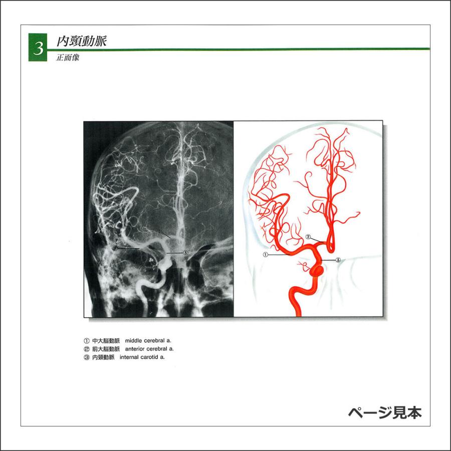 「造影写真付 血管カラーアトラス」解剖学図鑑 医学書籍