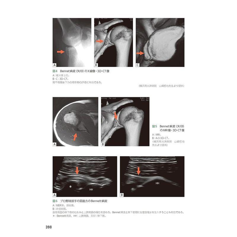 整形外科医のための 肩のスポーツ診療のすべて