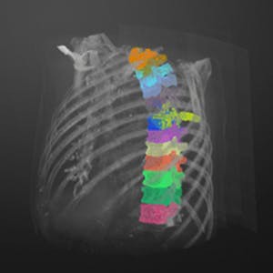 Medical Image Processing