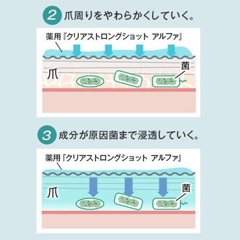 クリアストロングショット アルファ 北の快適工房 爪の中まで 殺菌