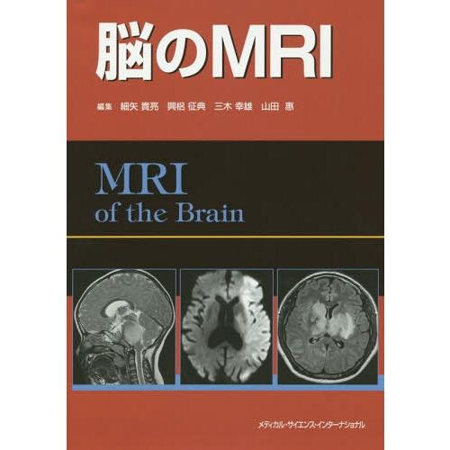 脳のMRI