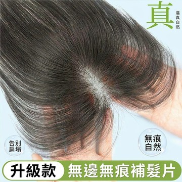 TOP🥇假髮女 頭頂髮片 補髮片 髮片遮白髮 7*11內網 蓬鬆真髮 隨意分縫 高顱頂假髮片 八字瀏海 法式瀏海 接髮片