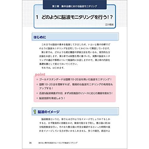 見えない発作を見逃さない ICUでの脳波モニタリング 神経集中治療に強くなる