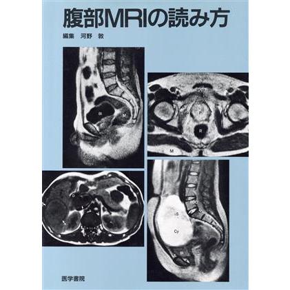 腹部ＭＲＩの読み方／河野敦(著者)