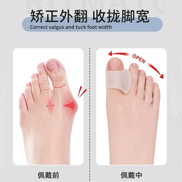 熱銷腳趾矯正器拇指外翻大母腳趾分趾器糾正大腳骨分離神器日夜可穿鞋
