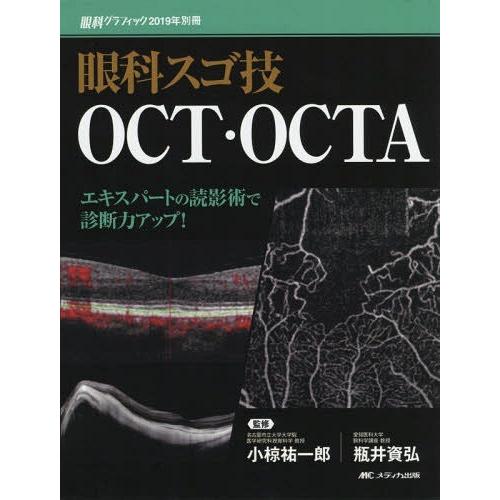 眼科スゴ技 OCT・OCTA エキスパートの読影術で診断力アップ