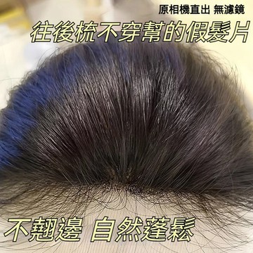 TOP🥇無需髮卡 假髮女 頭頂補髮片 仿真髮 增髮量 前額無邊瀏海魔術貼片 短髮假髮 假髮片 頭頂髮片 接髮 遮白髮頭飾