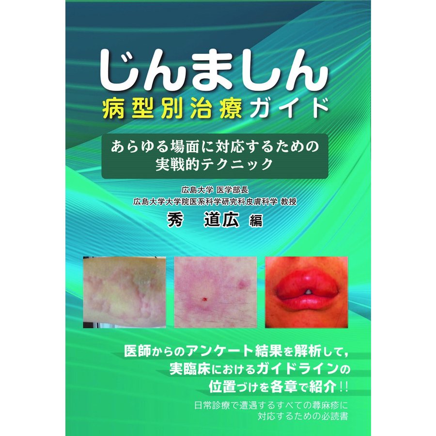 じんましん病型別治療ガイド あらゆる場面に対応するための実戦的テクニック