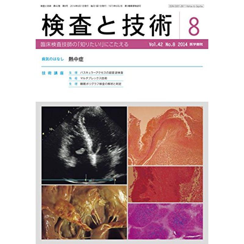 検査と技術 2014年 8月号