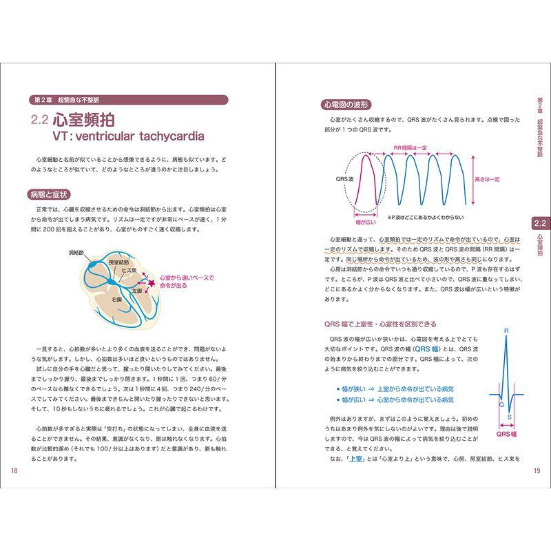 レジデントのための これだけ心電図