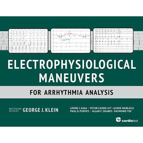 Electrophysiological Maneuvers for Arrhythmia Analysis