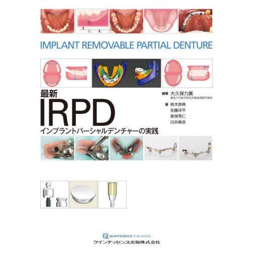 最新IRPDインプラントパーシャルデンチャーの実践
