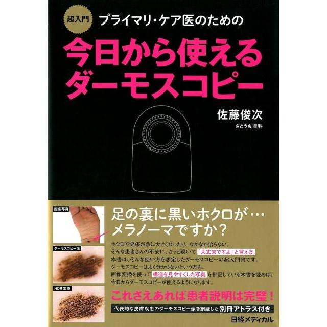 プライマリ・ケア医のための今日から使えるダーモスコピー 超入門 佐藤俊次 著 日経メディカル 編集