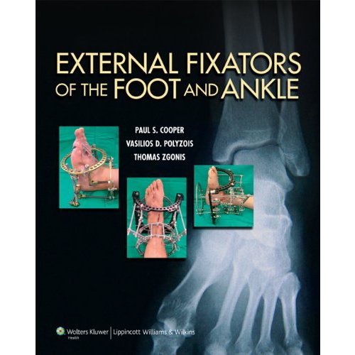 External Fixators of the Foot and Ankle