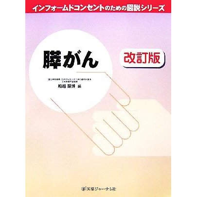 膵がん インフォームドコンセントのための図説シリーズ／船越顕博