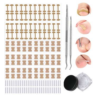 los1533正甲墊矯正器甲溝嵌甲卷甲拉伸腳趾貼片正甲工具套裝修甲剔甲器