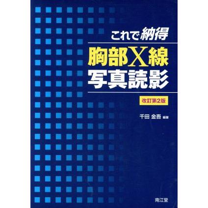 これで納得　胸部Ｘ線写真読影　改訂第２版／千田金吾(著者)