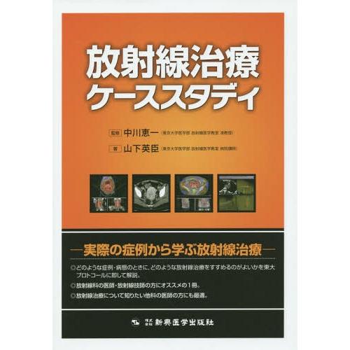 放射線治療ケーススタディ