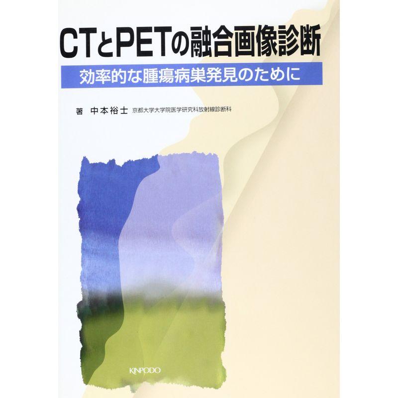 CTとPETの融合画像診断?効率的な腫瘍病巣発見のために