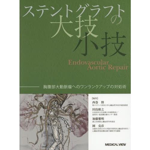 ステントグラフトの大技・小技 胸腹部大動脈瘤へのワンランクアップの対処術 西巻 博 他編集