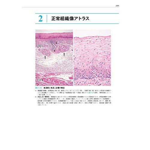 臨床に活かす病理診断学 第3版 消化管・肝胆膵編