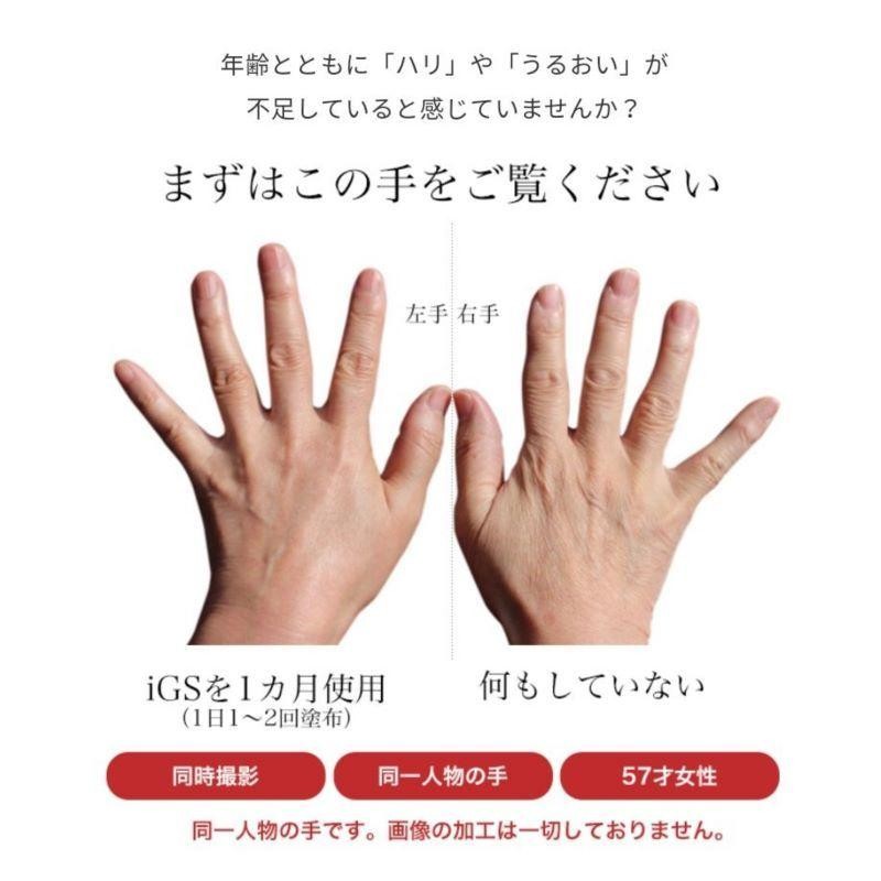 iGS4000Gel ジェル （６０包） ブドウ種子成分配合美容液 - スキンケア、基礎化粧品