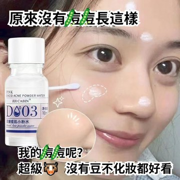 🔥現貨速發🚀公司正品✨🔥戰荳雙酸小粉水 痘肌小粉水 水楊酸精華液男女 痘痘肌 痘印 改善 肌膚水油平衡 收縮毛孔精華液