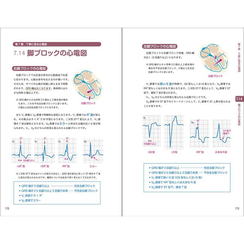 レジデントのための これだけ心電図