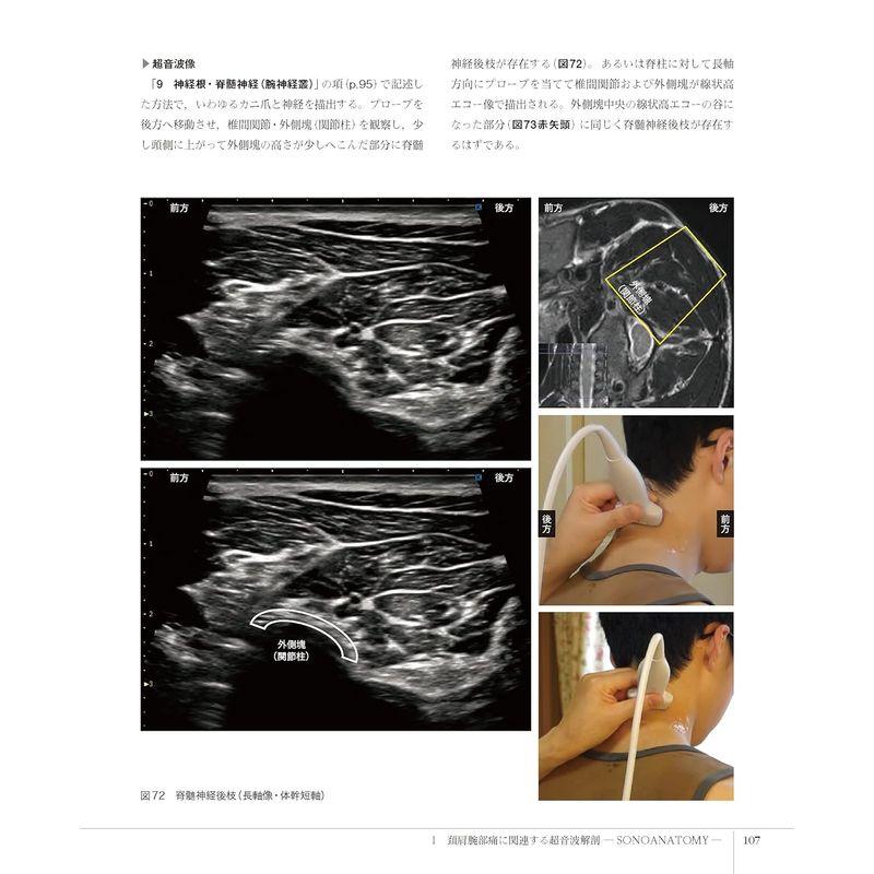 脊椎エコーのすべて 頚肩腕部・腰殿部痛治療のために -SONOANATOMY, TARGET and INTERVENTION-