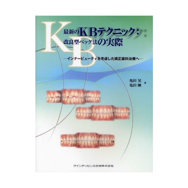 最新のKBテクニック 改良型ベッグ法の実際 インナービューティを考慮した矯正歯科治療へ