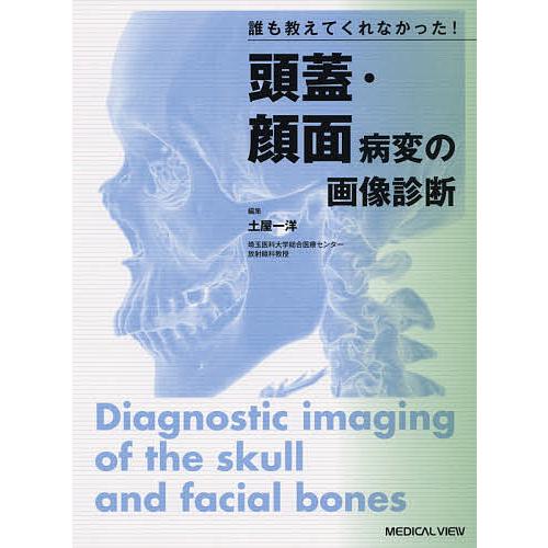 誰も教えてくれなかった 頭蓋・顔面病変の画像診断