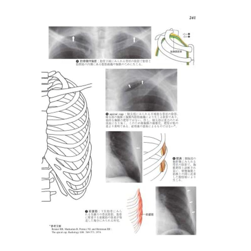 胸部X線・CT画像420症例