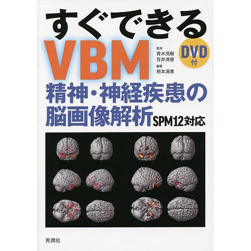 すぐできるVBM 精神・神経疾患の脳画像解析 SPM12対応 青木茂樹 笠井清登 根本清貴 SPM12