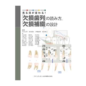 見る目が変わる 欠損歯列 の読み方, 欠損補綴 の設計