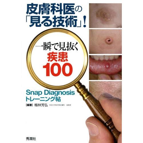 皮膚科医の 見る技術 一瞬で見抜く疾患100 Snap Diagnosisトレーニング帖