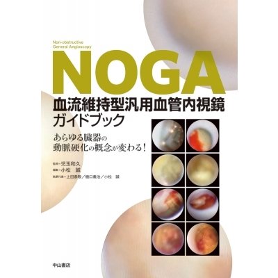 NOGA血流維持型汎用血管内視鏡ガイドブック あらゆる臓器の動脈硬化の概念が変わる!   児玉和久  〔本〕