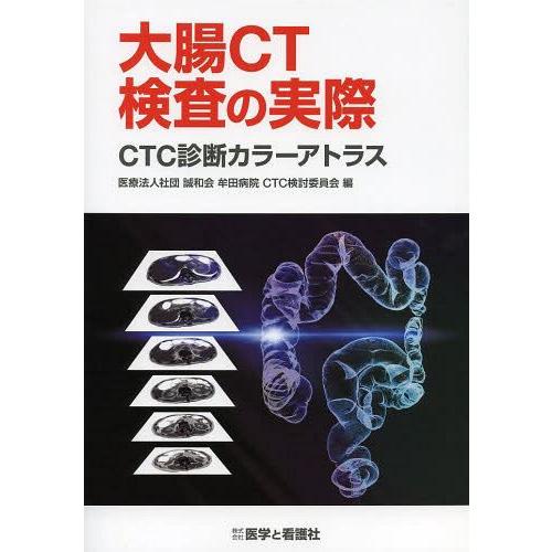 [本 雑誌] 大腸CT検査の実際 CTC診断カラーアトラス 誠和会牟田病院CTC検討委員会 編