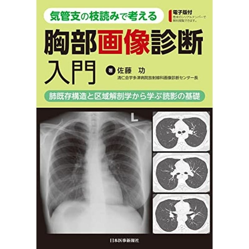 気管支の枝読みで考える　胸部画像診断入門　──　LINEショッピング　肺既存構造と区域解剖学から学ぶ読影の基礎　─　電子版付　─