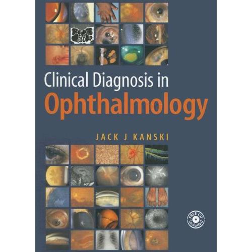 Clinical Diagnosis in Ophthalmology, 1e