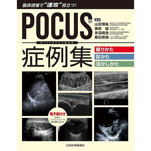 POCUS症例集撮りかた・診かた・活かしかた 臨床現場で 速攻 役立つ