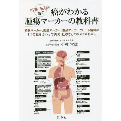 癌がわかる腫瘍マーカーの教科書 再発・転移を防ぐ 特異マーカー,関連マーカー,がん血管から出る情報の3つの組み合わせで再発・予防リスクがわかる