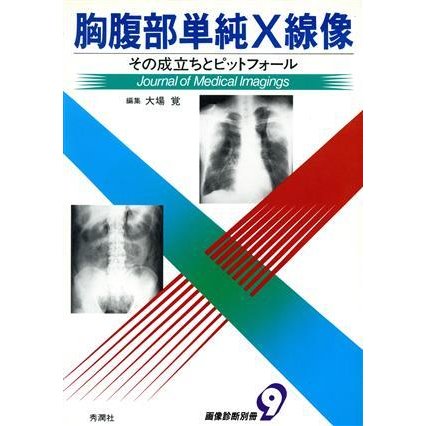 胸腹部単純Ｘ線像 その成立ちとピットフォール／大場覚(編者)