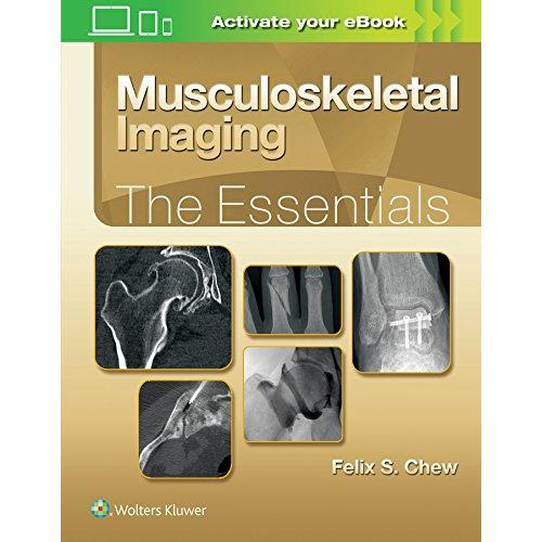 Musculoskeletal Imaging: The Essentials (Essentials Series)