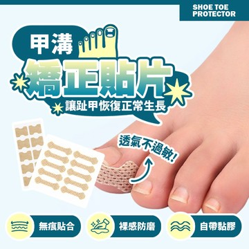 現貨 甲溝炎矯正貼 物理式矯正 告別疼痛 補漏神器 隱形防磨 彈力貼片 居家指甲護理 嵌甲專用貼【H646】