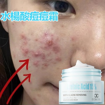 🔥【隔日送達】水楊酸痘痘霜 痘痘精華凝膠 痘痘粉刺調理 敏感肌可用 油水平衡 溫和不刺激 臉部保養