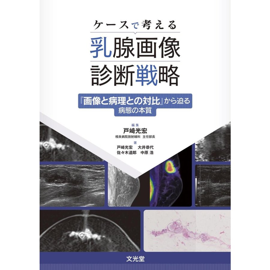 ケースで考える乳腺画像診断戦略 画像と病理との対比 から迫る病態の本質